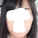 ボトックス（エラ・小顔） / 脂肪溶解注射（顔） / 脂肪溶解注射（二の腕） クリニックA.O. DAY 9 サムネイル用