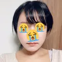 糸リフト / 脂肪吸引（顔） / その他（肌） ビューティーライン美容外科 DAY 13 サムネイル用
