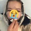 骨切り（あご） / 骨削り（エラ） ボンディ美容整形外科（旧リオン整形外科） DAY 0 サムネイル用