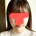 脂肪吸引（顔） / ボトックス（エラ・小顔） / 美容点滴・美容注射（美肌） エートップ美容整形外科 AFTER サムネイル用