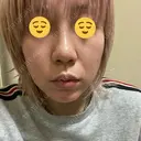 隆鼻術 品川美容外科 名古屋院 DAY 5 サムネイル用