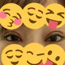 二重切開 / 目頭切開 / 鼻尖形成（切開） / 鼻中隔延長（切開） / 小鼻縮小（切開） / タレ目形成・グラマラスライン（切開） / 鼻尖縮小 / 鼻翼基部形成（貴族手術） グローバルビューティークリニック 大阪院 DAY 25 サムネイル用