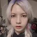 ガミースマイル手術 / セットバック / ルフォー+ssro（両あご) / 輪郭修正 / 矯正（ワイヤー） クラインデンタルクリニック DAY 27 サムネイル用