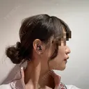 骨切り（あご） / 骨削り（エラ） ボンディ美容整形外科（旧リオン整形外科） DAY 30 サムネイル用