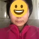 骨削り（エラ） / 骨削り（頬） / 脂肪吸引（顔） View美容整形外科 DAY 176 サムネイル用