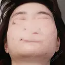 骨削り（頬） / 脂肪注入（肌） ボンディ美容整形外科（旧リオン整形外科） DAY 282 サムネイル用