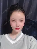 骨切り（あご） / 骨削り（頬） / 脂肪吸引（顔） / 鼻修正 / 脂肪注入（輪郭） DI（ディアイ）整形外科 DAY 210 サムネイル用