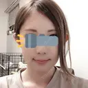 骨切り（あご） / 骨削り（頬） リラ・クラニオフェイシャル・クリニック DAY 10 サムネイル用