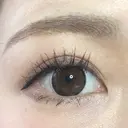 眉下切開 もとび美容外科クリニック 新宿院 DAY 190 サムネイル用