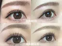 眉下切開 もとび美容外科クリニック 新宿院 DAY 190 サムネイル用