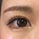 眉下切開 もとび美容外科クリニック 新宿院 AFTER サムネイル用