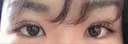 二重埋没 / 上まぶたの脂肪取り TCB東京中央美容外科 江坂院 DAY 3 サムネイル用