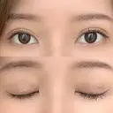 二重埋没 / 目元修正 BIANCA銀座 DAY 4 サムネイル用