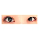 二重切開 神野美容形成外科クリニック DAY 46 サムネイル用