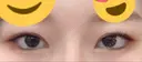 目頭切開 / 下まぶたの脂肪取り / タレ目形成・グラマラスライン（切開） ララ整形外科 DAY 41 サムネイル用
