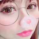 二重埋没 ビスポーククリニック 福岡院 DAY 13 サムネイル用