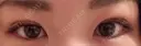 二重埋没 / 上まぶたの脂肪取り TCB東京中央美容外科 江坂院 DAY 9 サムネイル用