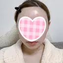 糸リフト / 骨削り（頬） / 脂肪吸引（顔） RG整形外科（旧リオン整形外科） AFTER サムネイル用