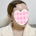 糸リフト / 骨削り（頬） / 脂肪吸引（顔） RG整形外科（旧リオン整形外科） DAY 90 サムネイル用