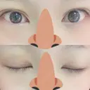 二重埋没 / 眼瞼下垂（切開） / その他（目元） 湘南美容クリニック 福島院 DAY 7 サムネイル用
