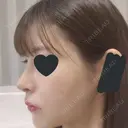 鼻尖形成（切開） / 鼻中隔延長（切開） / 小鼻縮小（切開） / その他（鼻） / 軟骨移植 / 骨切幅寄せ / 眉間プロテーゼ / プロテーゼ除去 / 鼻修正 / 鼻尖縮小 FROM B整形外科 (旧バウム整形外科) DAY 12 サムネイル用