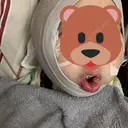 骨切り（あご） / 骨削り（エラ） ボンディ美容整形外科（旧リオン整形外科） DAY 0 サムネイル用