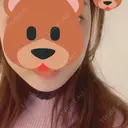 骨切り（あご） / 骨削り（エラ） ボンディ美容整形外科（旧リオン整形外科） DAY 7 サムネイル用