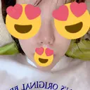 鼻尖形成（切開） / ヒアルロン酸注入（鼻） 東京ヒルズクリニック 新宿院 DAY 13 サムネイル用