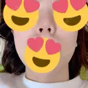 鼻尖形成（切開） / ヒアルロン酸注入（鼻） 東京ヒルズクリニック 新宿院 DAY 13 サムネイル用