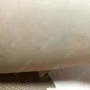 その他（ボディ） 肌と歯のクリニック 東京ベイ幕張 DAY 4 サムネイル用