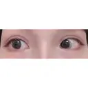 二重切開 / 目頭切開 / 上まぶたの脂肪取り / 蒙古ひだ形成 FROM B整形外科 (旧バウム整形外科) DAY 315 サムネイル用