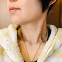 バッカルファット除去 TCB東京中央美容外科 堺院 DAY 8 サムネイル用