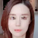 あごプロテーゼ / 骨削り（エラ） / 骨削り（頬） GNG美容外科 DAY 335 サムネイル用