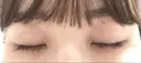 二重埋没 / 上まぶたの脂肪取り TCB東京中央美容外科 江坂院 DAY 112 サムネイル用