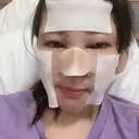 目頭切開 / 鼻尖形成（切開） / 鼻中隔延長（切開） 湘南美容クリニック 金沢院 AFTER サムネイル用