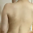 GLP-1ダイエット / 脂肪溶解注射（二の腕） / その他（ボディ） 湘南美容クリニック 新橋銀座口院 DAY 9 サムネイル用