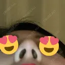 鼻尖形成（切開） / 鼻中隔延長（切開） / 軟骨移植 表参道スキンクリニック 表参道院 DAY 60 サムネイル用
