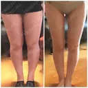 ボトックス（ふくらはぎ） / その他（ボディ） プチパーティー医院 DAY 246 サムネイル用