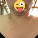 脂肪溶解注射（顔） / 脂肪溶解注射（二の腕） / ボトックス（肩） / その他（ボディ） 品川スキンクリニック京都院 DAY 5 サムネイル用