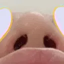 鼻尖形成（切開） / 小鼻縮小（切開） / 鼻孔縁挙上 銀座TAクリニック DAY 31 サムネイル用