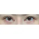 目頭切開 ドクター松井クリニック 新宿 DAY 0 サムネイル用
