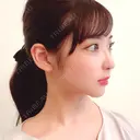 骨削り（頬） / 脂肪吸引（顔） / ボトックス（エラ・小顔） / ボトックス（ふくらはぎ） / ヒアルロン酸注入（額） / ボトックス（肩） RG整形外科（旧リオン整形外科） DAY 139 サムネイル用