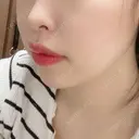 脂肪溶解注射（顔） 赤坂プレミアクリニック DAY 3 サムネイル用