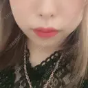 脂肪溶解注射（顔） 赤坂プレミアクリニック DAY 5 サムネイル用