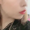 脂肪溶解注射（顔） 赤坂プレミアクリニック DAY 5 サムネイル用