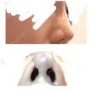 鼻尖縮小 東京ヒルズクリニック 新宿院 DAY 0 サムネイル用