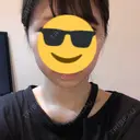 ボトックス（エラ・小顔） 東京ヒルズクリニック 新宿院 DAY 2 サムネイル用