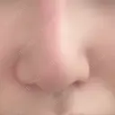 鼻尖形成（切開） / 小鼻縮小（切開） / 鼻孔縁挙上 銀座TAクリニック DAY 49 サムネイル用