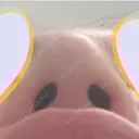 鼻尖形成（切開） / 小鼻縮小（切開） / 鼻孔縁挙上 銀座TAクリニック DAY 49 サムネイル用