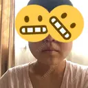 その他（輪郭） 品川美容外科 静岡院 DAY 63 サムネイル用